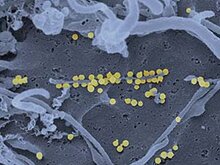 Crimean-Congo Hemorrhagic Fever Virus