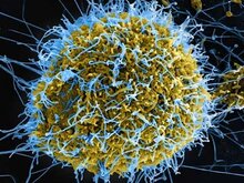 Ebola Zaire