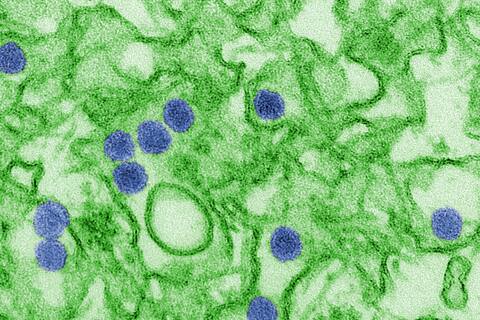 Zika Virus